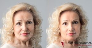 Odmłodzenie skóry twarzy