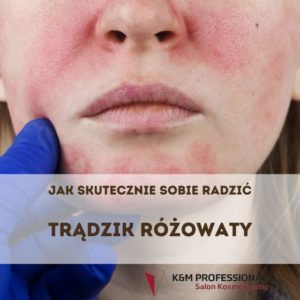 Jak wygląda trądzik różowaty