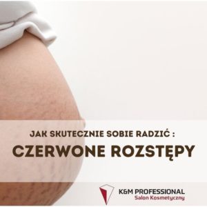 Czerwone rozstępy - postępowanie