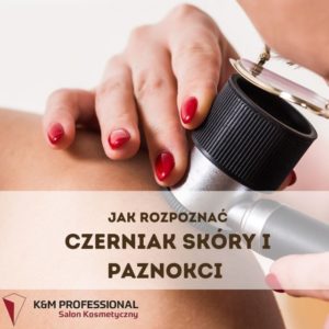 Jak rozpoznać czerniaka paznokci
